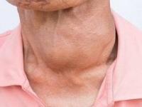 تعادل تیروئید