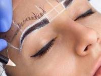 کاشت ابرو