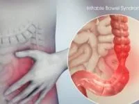 سندروم روده