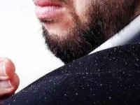 Dandruff