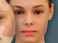 ارتباط ظاهر با بیماری