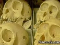 جراحی جمجمه