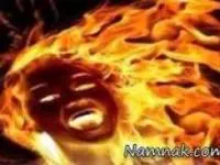 سوختن زن