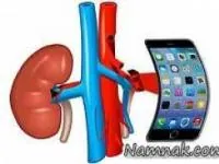 فروش کلیه