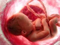 تولد نوزاد