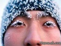 صورت یخ زده