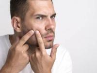 لیزر جای جوش