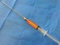 تزریق چربی به ران