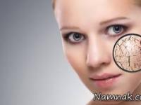 پوستی درخشان