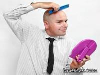 طاسی مردانه