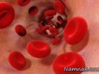 تری گلیسیرید