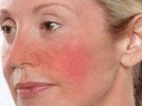 پوست های حساس