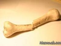 خطر-پوکی -استخوان