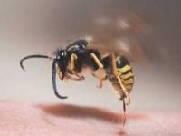 درمان نیش زنبور