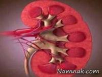 مراقبت از سلامت کلیه ها