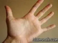 بهداشت و سلامت پوست