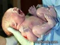 زایمان بدون درد