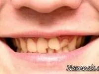 دندان