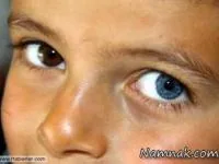 چشم های متفاوت
