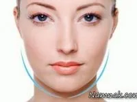 چاقی صورت