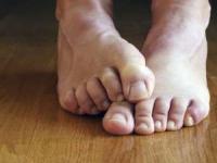 خواب رفتگی پا