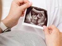 هفته هفدهم بارداری