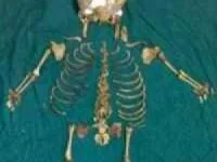 اسکلت جنین