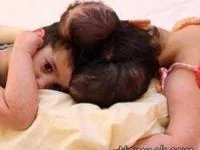 دوقلوهای بهم چسبیده
