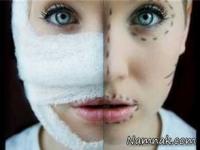 عمل های زیبایی