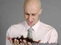 تعداد طبیعی ریزش مو