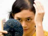 ریزش موی خانمها