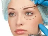 مشکلات دور چشم