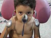 بدن آهنربایی