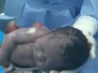 نوزاد شکم مادر