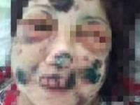 مرد آدمخوار