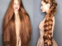 ریزش مو کچل شدن