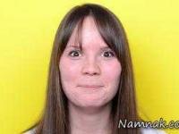 قرمز شدن گونه ها