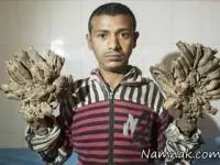 بیماری وحشتناک