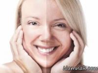 پیرشدن پوست