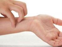 خارش دوران بارداری