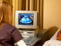 سونوگرافی در بارداری