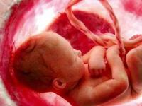 قصاص سقط جنین