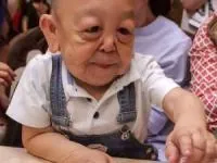 بیماری ژنتیکی پسر بچه 6 ساله