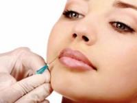 تزریق فیلر لب