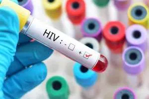 واکسن ایدز HIV