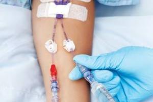 شیمی درمانی