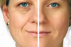 ماسک زیبایی