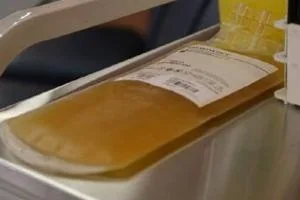 پلاسمادرمانی