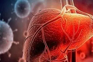 عفونت کووید ۱۹