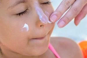 آفتاب سوختگی
